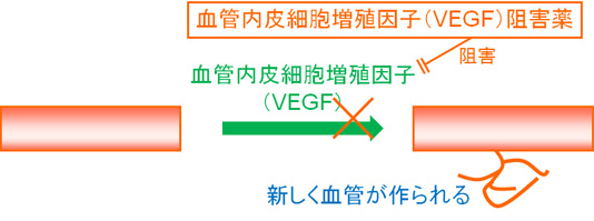 VEGF阻害薬
