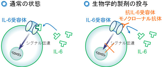 アクテムラ（トシリズマブ）の作用機序：抗IL-6受容体モノクローナル抗体